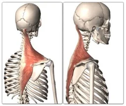 Skeleton Traps